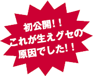 初公開！！これが生えグセの原因でした！！